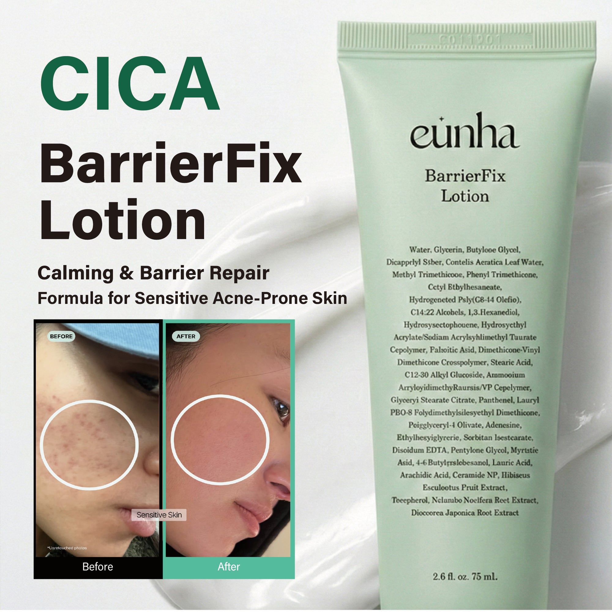 Cica 3-Step Acne Calming Giftset Box